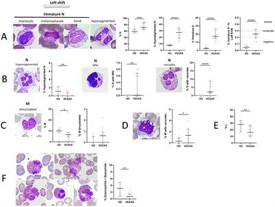 Expanding the VEXAS diagnostic workup: the role of peripheral blood cytological analysis